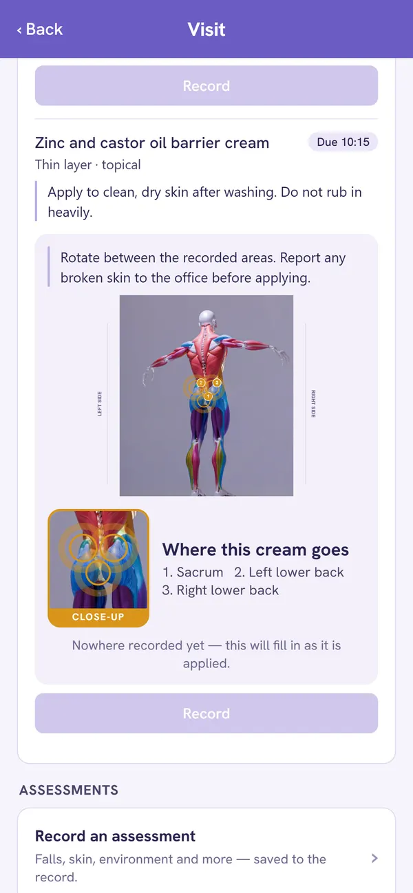 Nanum carer app: during the visit the carer sees exactly where the cream goes, on the body map